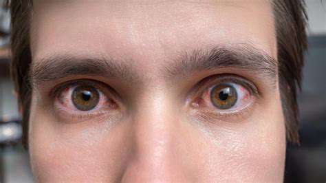Gene Editing for Vision Improvement